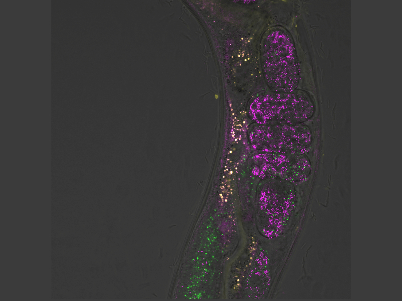 Upgrade konfokálního mikroskopu na CARS mikroskopii